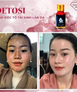 shop unni phân phối thải độc tó tái sinh làn da ismaen
